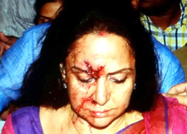 Hema Malini injured in a road accident