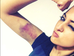 Check out: Sonakshi Sinha flaunts her bruised arm on the sets of Akira