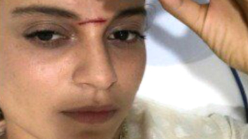 OMG! Kangna Ranaut gets SEVERELY INJURED while shooting for Manikarnika- The Queen Of Jhansi