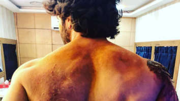GUESS WHO? This actor gets BRUISED during battle sequence shoot