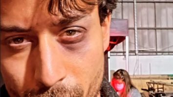 Tiger Shroff suffers an eye injury while filming Ganapath in the UK, shares photo